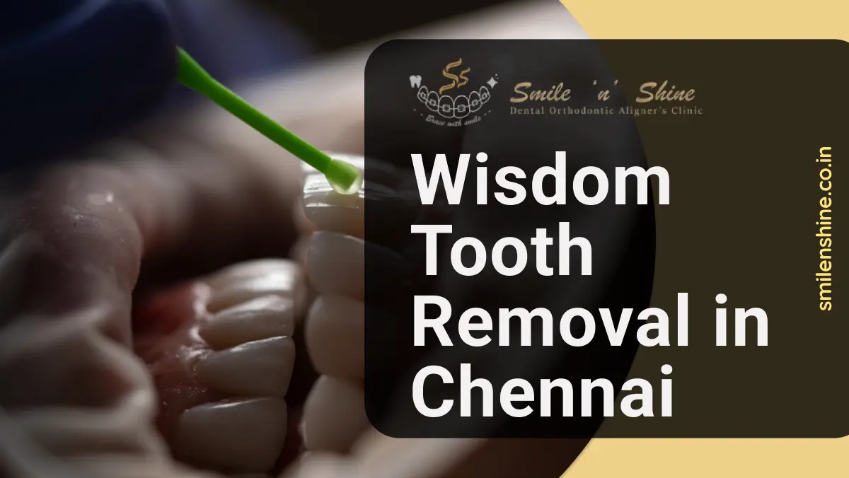 Wisdom tooth removal | smilnshine